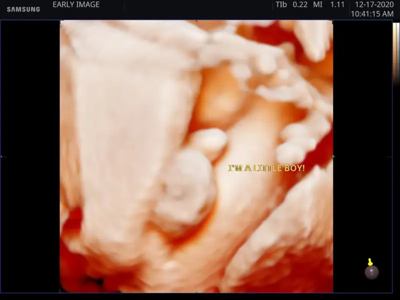 I’m a little boy (Live 5D)