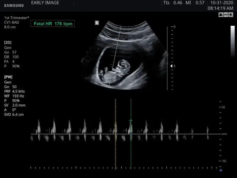 Such a strong heartbeat